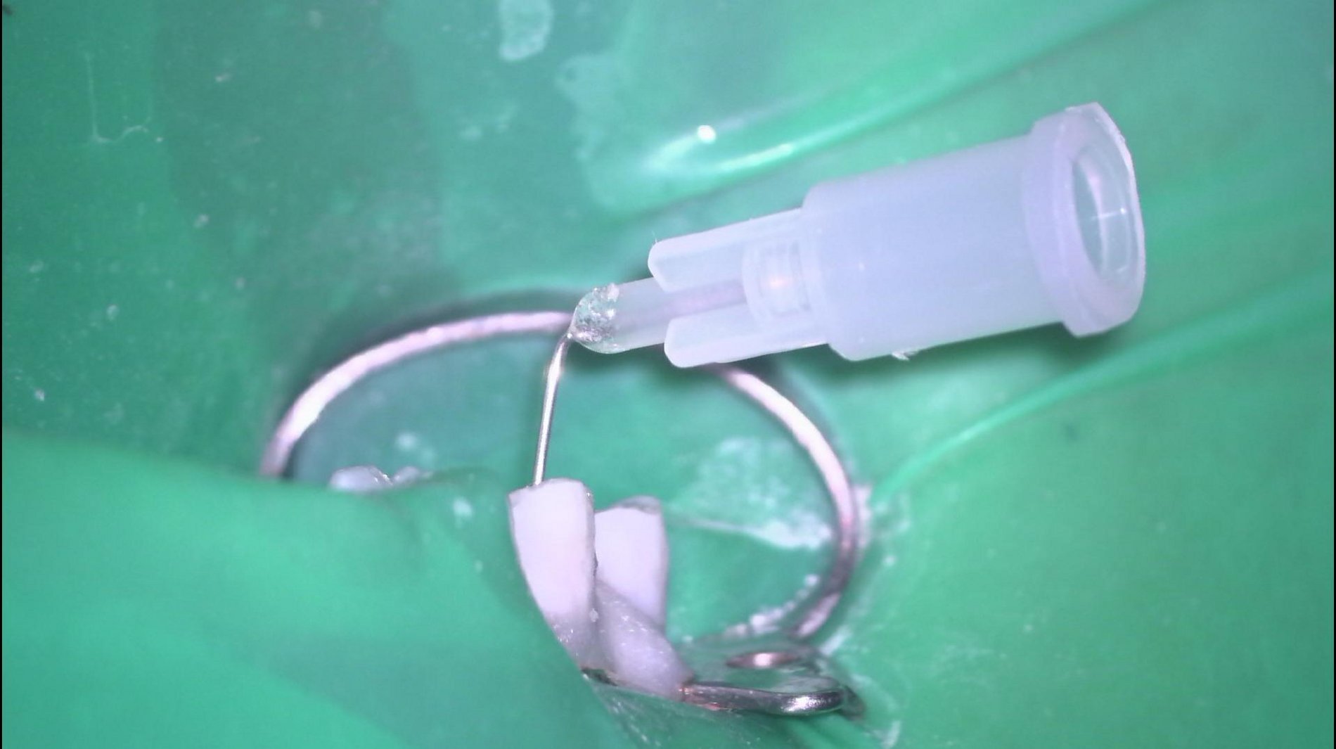 Tube-Technik AllDent 