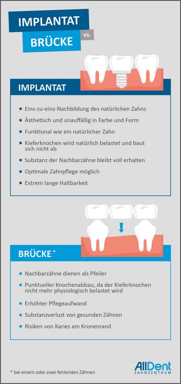 Infografik Zahnimplantate Brücken AllDent 