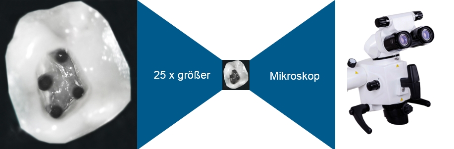 Endodontie Mikroskop AllDent