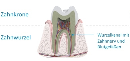 Zahnwurzel AllDent 